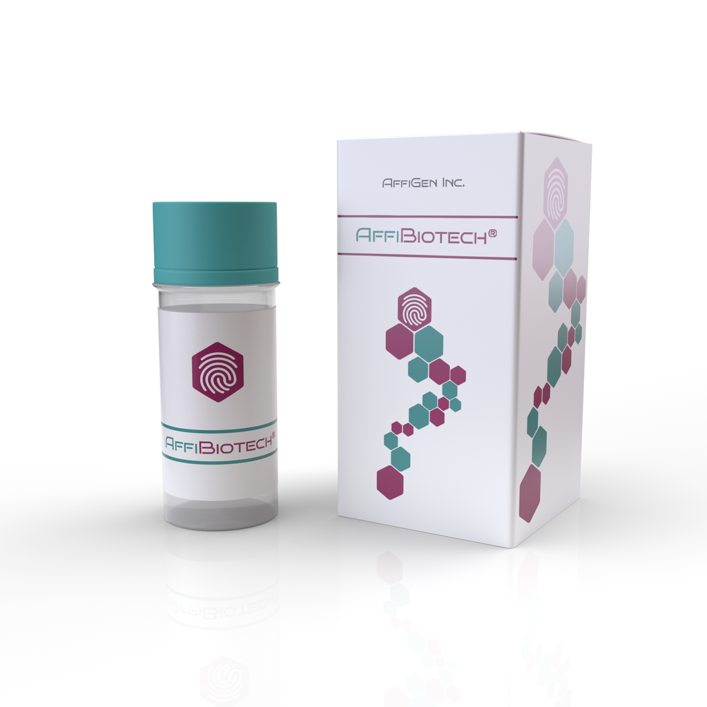 AffiBIOTECH® Human CRP POCT Systems-25 Tests 